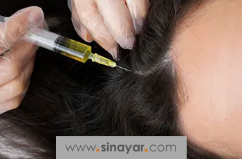 مراقبت های بعد از مزوتراپی مو؛ نکات طلایی که باید بدانید