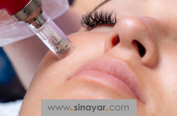 مراقبت های بعد از میکرونیدلینگ؛ نکات ضروری برای بهترین نتیجه