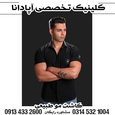 کاشت  مو
