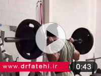 تزریق بوتاکس برای رفع تعریق زیر بغل