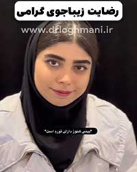 رضایت زیباجوی گرامی از عمل بینی بعد از سه ماه