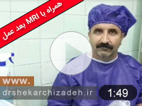 ویدئوی شماره112 -دیسک L5S1 اکسترود چپ،درمان و بهبودی با لیزر پلاسما، مقایسه MRI قبل و دوماه بعد عمل