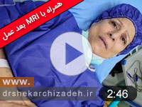 ویدئوی شماره124- دیسک اکسترودL3L4 و L4L5 هفت ماه بعد از عمل، مقایسه ویدیو و MRI قبل و بعد