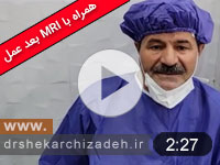 ویدئوی شماره125- دیسک اکسترودL4L5 با سابقه دوماهه درمان با لیزر پلاسما، ویدیو و MRI چهارماه بعد عمل