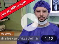 ویدئوی شماره132-دیسک اکسترود شدیدL5S1 درمان با لیزر پلاسما، مقایسه MRI قبل و 9 ماه بعد عمل