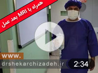 ویدئوی شماره 135-دیسک اکسترودL2L3 درمان با لیزر پلاسما، ویدیو و MRI  نه ماه بعد از عمل بهبودی کامل