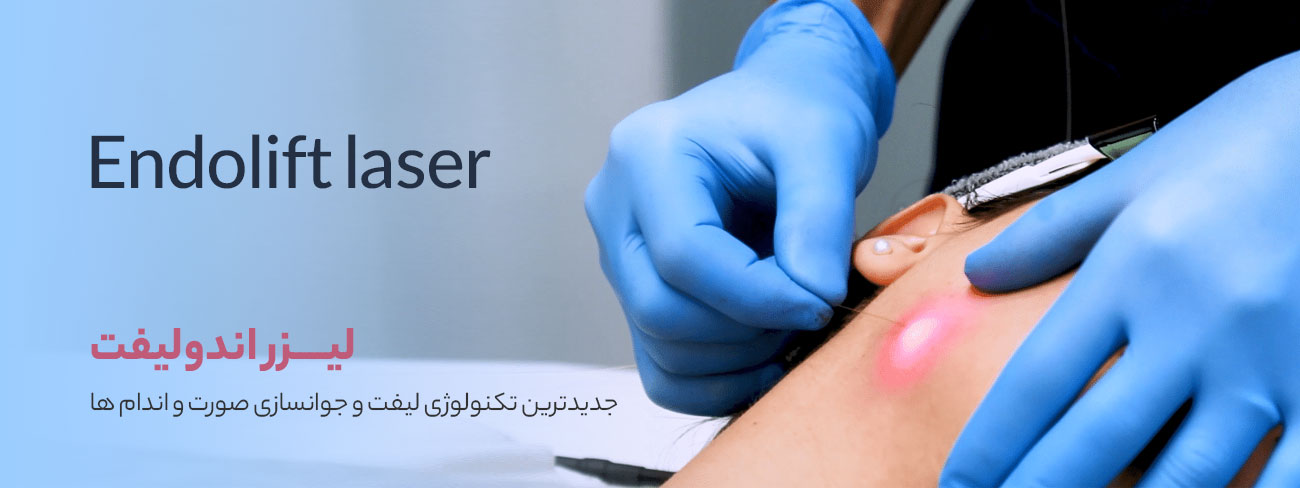 لیزر اندولیفت