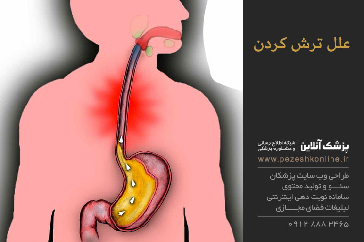 پیشگیری از ترش کردن