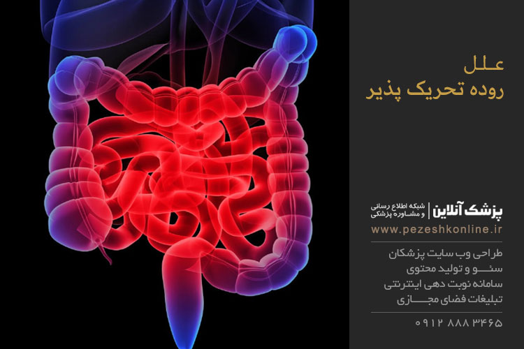 درمان  روده تحریک پذیر