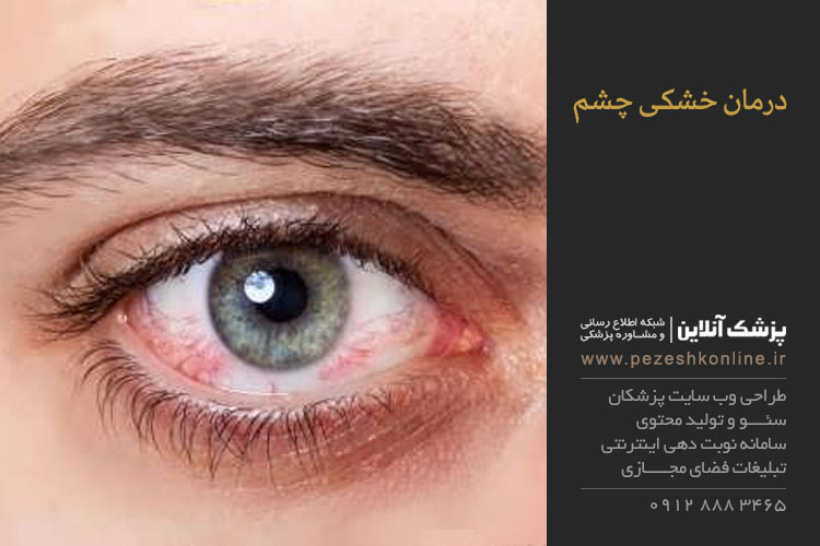 خشکی چشم
