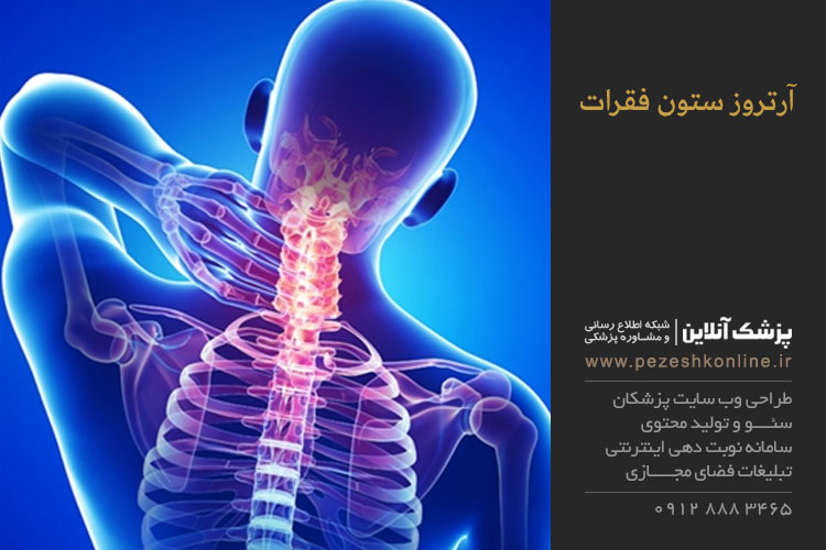 آرتروز ستون فقرات