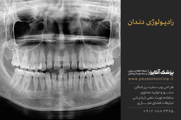 رادیولوژی دندان