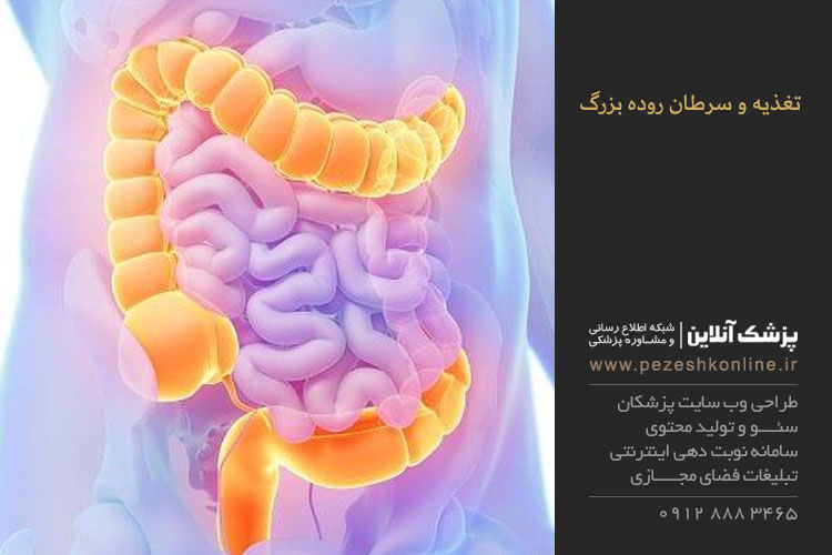 سرطان روده بزرگ و تغذیه