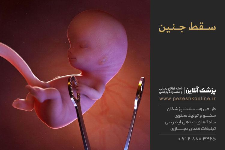 سقط جنین و علل آن