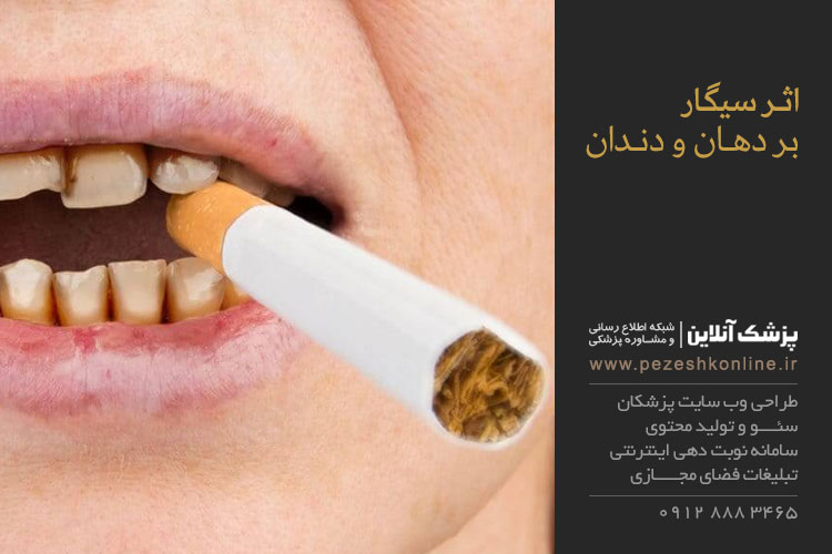 تاثیر سیگار برسلامت دهان