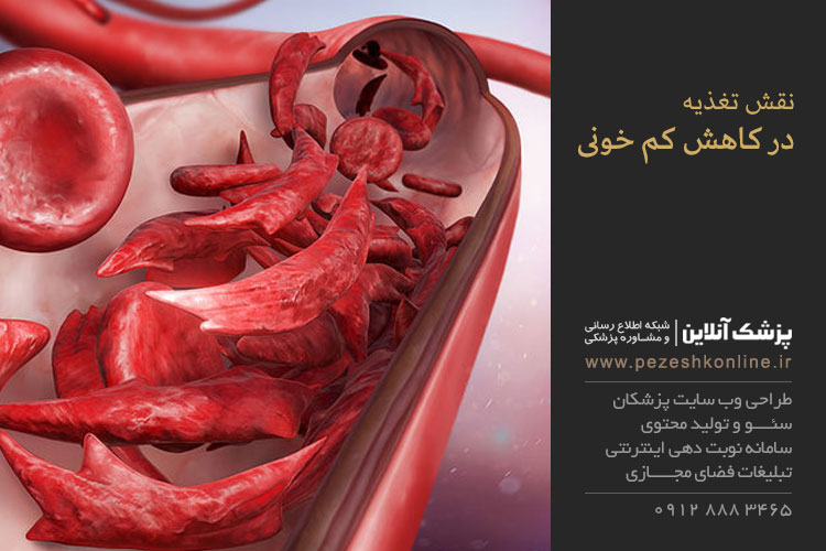 نقش تغذیه در کاهش کم خونی