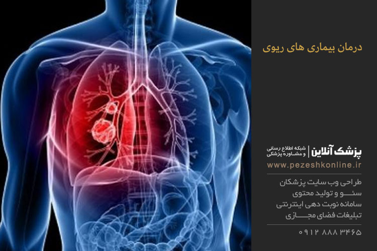 درمان بیماری های ریوی