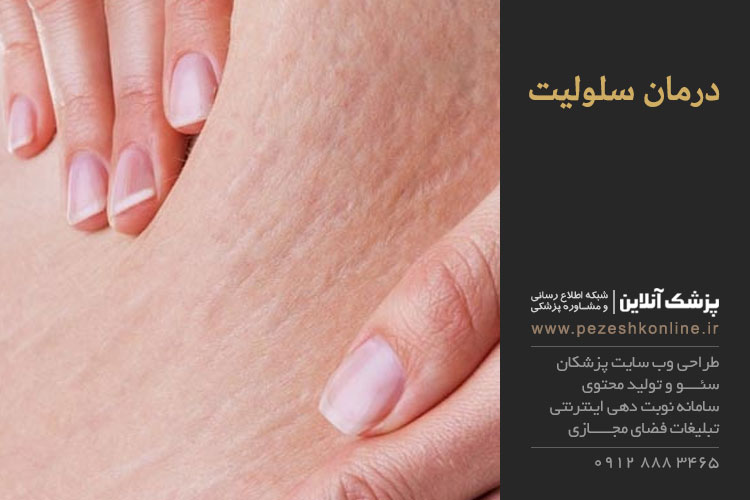 چاقی موضعی و رفع آن