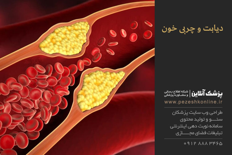 چربی خون و دیابت