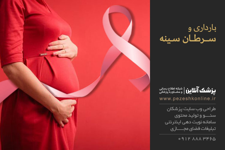 بارداری و سرطان سینه