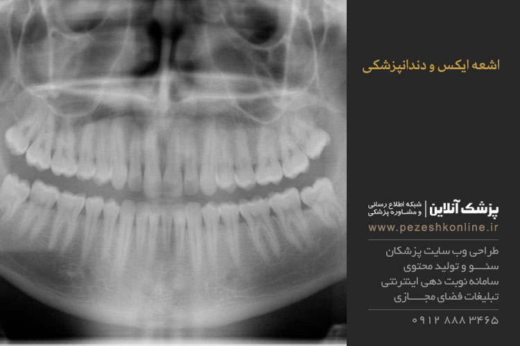 اشعه ایکس و دندانپزشکی
