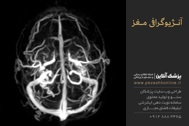 آنژیوگرافی مغز