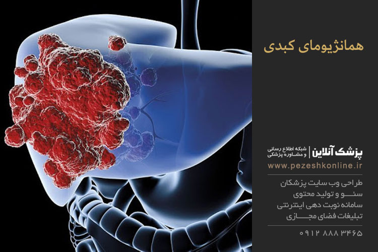 علل همانژیومای کبدی