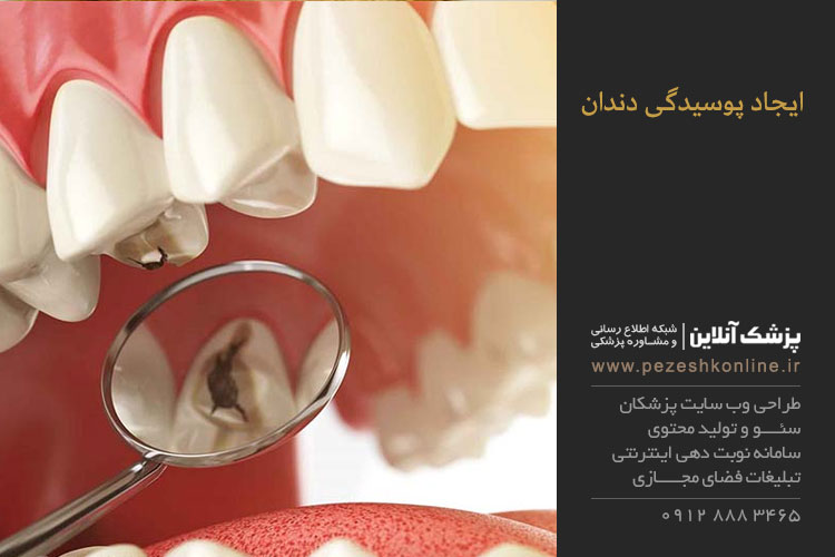 درمان پوسیدگی دندان